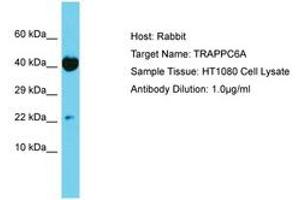 Image no. 1 for anti-Trafficking Protein Particle Complex 6A (TRAPPC6A) (AA 21-70) antibody (ABIN6750666)