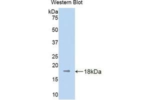 Western blot analysis of the recombinant protein. (KIF5A antibody  (AA 473-605))