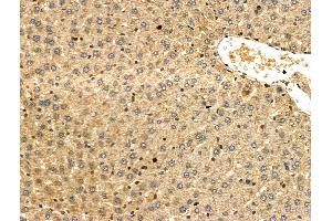 ABIN6257431 and ABIN6275975 at 1/100 staining Rat liver tissue by IHC-P. (PTH1R antibody  (Internal Region))