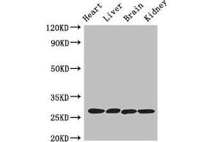 Western Blot Positive WB detected in: Mouse heart tissue, Mouse liver tissue, Mouse brain tissue, Mouse kidney tissue All lanes: PRSS2 antibody at 3 μg/mL Secondary Goat polyclonal to rabbit IgG at 1/50000 dilution Predicted band size: 27 kDa Observed band size: 27 kDa (PRSS2 antibody  (AA 24-247))