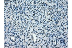 Immunohistochemical staining of paraffin-embedded colon tissue using anti-TMEM100mouse monoclonal antibody. (TMEM100 antibody)