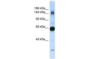 Collagen Type XI Alpha 2 antibody used at 1 ug/ml to detect target protein. (COL11A2 antibody  (N-Term))