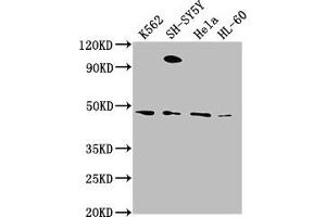 Western Blot Positive WB detected in: K562 whole cell lysate, SH-SY5Y whole cell lysate, Hela whole cell lysate, HL-60 whole cell lysate All lanes: RTN4RL2 antibody at 1:2000 Secondary Goat polyclonal to rabbit IgG at 1/50000 dilution Predicted band size: 47, 22 kDa Observed band size: 47 kDa