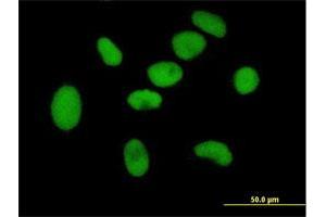 Immunofluorescence of purified MaxPab antibody to ZNF189 on HeLa cell.