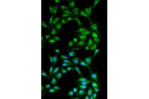 Immunofluorescence analysis of MCF7 cell using ICOS antibody. (ICOS antibody  (AA 21-140))