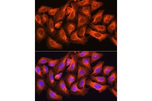 Immunofluorescence (IF) image for anti-Cytoskeleton Associated Protein 5 (CKAP5) (AA 1763-2032) antibody (ABIN6138647)