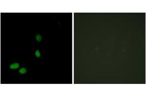 Immunofluorescence analysis of HeLa cells, using HMG17 Antibody.