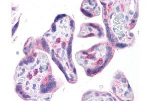 Immunohistochemistry (IHC) image for anti-Leucine Rich Repeat Containing 59 (LRRC59) (N-Term) antibody (ABIN2783711) (LRRC59 antibody  (N-Term))