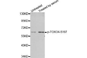 Western Blotting (WB) image for anti-Forkhead Box O4 (FOXO4) (pSer197) antibody (ABIN1870198) (FOXO4 antibody  (pSer197))