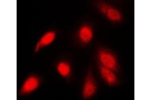 Immunofluorescent analysis of NF-kappaB p65 (pS311) staining in PC12 cells. (NF-kB p65 antibody  (pSer311))