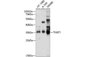 Western blot analysis of extracts of various cell lines, using TNNT1 antibody (ABIN6127683, ABIN6149363, ABIN6149364 and ABIN6214579) at 1:1000 dilution. (TNNT1 antibody  (AA 1-262))