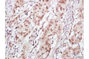 ZFPM1 antibody