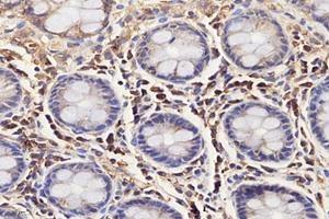Immunohistochemistry analysis of paraffin-embedded human colon using,IL-3RB (ABIN7073557) at dilution of 1: 4000 (CD131 antibody)
