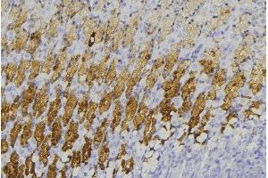 ABIN6273593 at 1/100 staining Human gastric tissue by IHC-P. (TRIM31 antibody  (Internal Region))