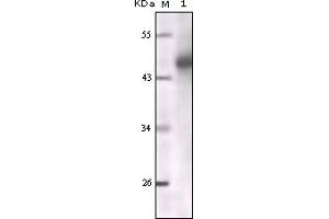 Western Blotting (WB) image for anti-Keratin 1 (KRT1) (truncated) antibody (ABIN2464043) (Cytokeratin 1 antibody  (truncated))