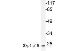 Western blot analysis of Skp1 p19 antibody in extracts from COS7 cells. (SKP1 antibody)