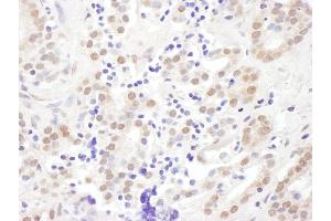 Immunohistochemistry (IHC) image for anti-Exosome Component 10 (EXOSC10) (AA 200-250) antibody (ABIN7454996)