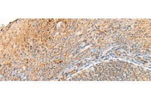 Immunohistochemistry of paraffin-embedded Human tonsil tissue using GPR161 Polyclonal Antibody at dilution of 1:40(x200) (GPR161 antibody)