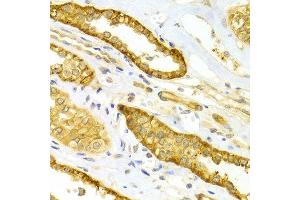 Immunohistochemistry of paraffin-embedded Human kidney using SELE antibody at dilution of 1:100 (x400 lens).