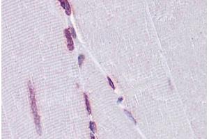 Human Skeletal muscle: Formalin-Fixed, Paraffin-Embedded (FFPE) (EMX2 antibody  (AA 103-201))