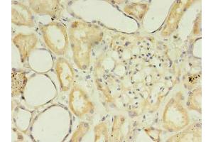 Immunohistochemistry of paraffin-embedded human kidney tissue using ABIN7169587 at dilution of 1:100 (SFXN2 antibody  (AA 1-99))