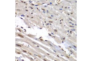 Immunohistochemistry of paraffin-embedded mouse heart using HNRNPM antibody (ABIN5975447) at dilution of 1/100 (40x lens). (HNRNPM antibody)