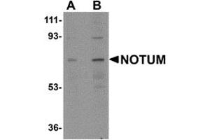 Western Blotting (WB) image for anti-Notum Pectinacetylesterase Homolog (NOTUM) (N-Term) antibody (ABIN1031488) (NOTUM antibody  (N-Term))