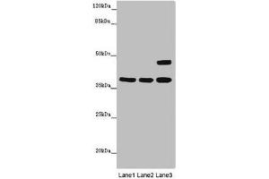 Western blot analysis (1) Thp1 whole cell lysates, (2) K562 whole cell lysates, and (3) Mouse brain tissue, using MR1 antibody (6 μg/ml) and Goat anti-Rabbit IgG polyclonal secondary antibody (1/10000 dilution). (MR1 antibody  (AA 150-253))