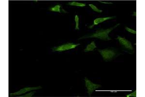 Immunofluorescence of monoclonal antibody to MAPK3 on HeLa cell. (ERK1 antibody  (AA 279-379))