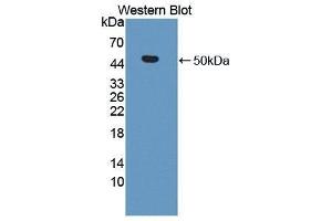 Western Blotting (WB) image for anti-Matrix Metallopeptidase 19 (MMP19) (AA 98-508) antibody (ABIN1869238) (MMP19 antibody  (AA 98-508))