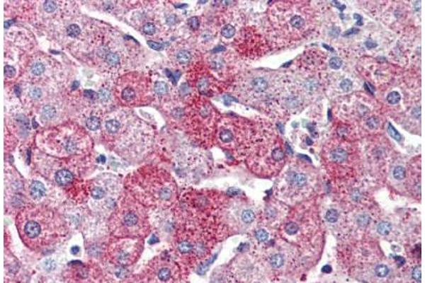 G Protein-Coupled Receptor 126 antibody  (Internal Region)