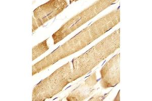 Immunohistochemistry (Paraffin-embedded Sections) (IHC (p)) image for anti-Interleukin 6 Signal Transducer (Gp130, Oncostatin M Receptor) (IL6ST) (AA 871-899), (C-Term) antibody (ABIN655059)