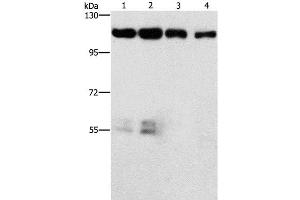 Western Blot analysis of Hela and hepG2 cell, lovo cell and Human colon cancer tissue using CDK11B Polyclonal Antibody at dilution of 1:750 (CDK11 antibody)