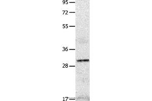 Western blot analysis of A549 cell  , using IL2RA Polyclonal Antibody at dilution of 1:750 (CD25 antibody)