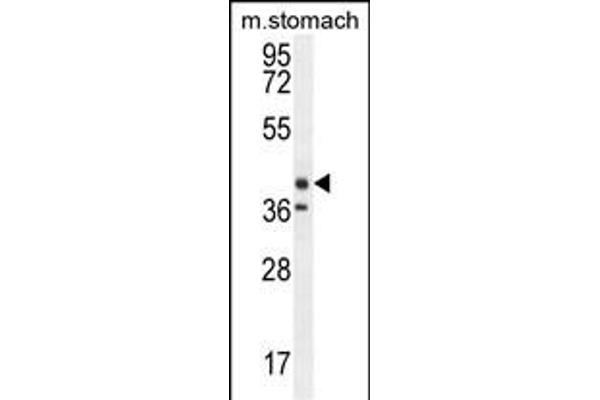TECTB 抗体  (N-Term)