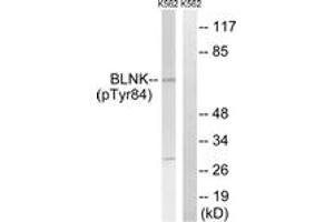 Western blot analysis of extracts from K562 cells treated with starved 24h, using BLNK (Phospho-Tyr84) Antibody. (B-Cell Linker antibody  (pTyr84))