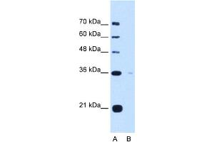 WB Suggested Anti-TOR1B Antibody Titration:  5.