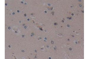 Detection of TLR9 in Human Cerebrum Tissue using Polyclonal Antibody to Toll Like Receptor 9 (TLR9) (TLR9 antibody  (AA 28-362))