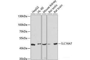 Western blot analysis of extracts of various cell lines using SLC16A7 Polyclonal Antibody at dilution of 1:3000. (SLC16A7 antibody)