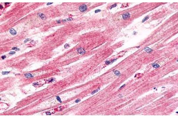 CCRL1 antibody  (Cytoplasmic Domain)