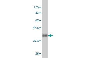 Western Blot detection against Immunogen (36. (PIN1 antibody  (AA 64-163))