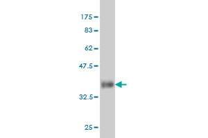 Western Blot detection against Immunogen (36. (PIN1 antibody  (AA 64-163))