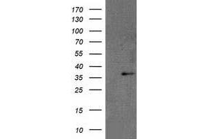 Western Blotting (WB) image for anti-Retinol Dehydrogenase 14 (All-Trans/9-Cis/11-Cis) (RDH14) antibody (ABIN1500655) (RDH14 antibody)