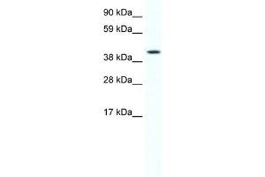 WB Suggested Anti-FOXF1A Antibody Titration:  2. (FOXF1 antibody  (C-Term))