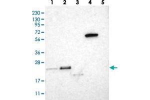 Western blot analysis of Lane 1: RT-4, Lane 2: U-251 MG, Lane 3: Human Plasma, Lane 4: Liver, Lane 5: Tonsil with TEX261 polyclonal antibody  at 1:250-1:500 dilution. (TEX261 antibody)