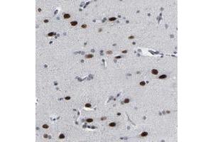 Immunohistochemical staining of human cerebral cortex with FAM180A polyclonal antibody  shows strong nuclear positivity in neuronal cells at 1:20-1:50 dilution. (FAM180A antibody)