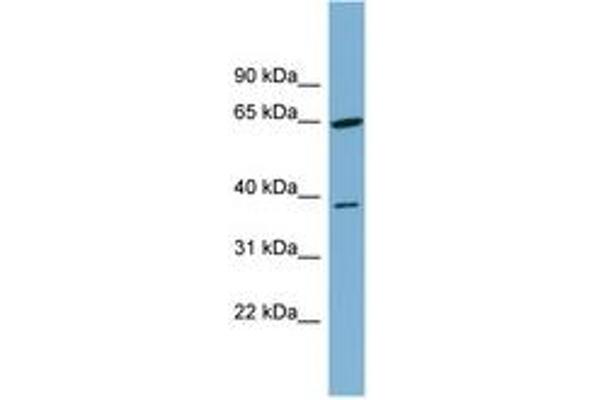 Carkd anticorps  (AA 251-300)