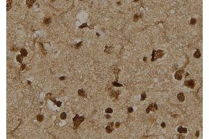 ABIN6276393 at 1/100 staining Human brain tissue by IHC-P. (TCTN3 antibody  (Internal Region))