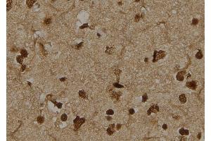 ABIN6276393 at 1/100 staining Human brain tissue by IHC-P.