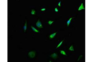 Immunofluorescence staining of SH-SY5Y cells with ABIN7157420 at 1:133, counter-stained with DAPI. (Cytokeratin 2 antibody  (AA 173-283))